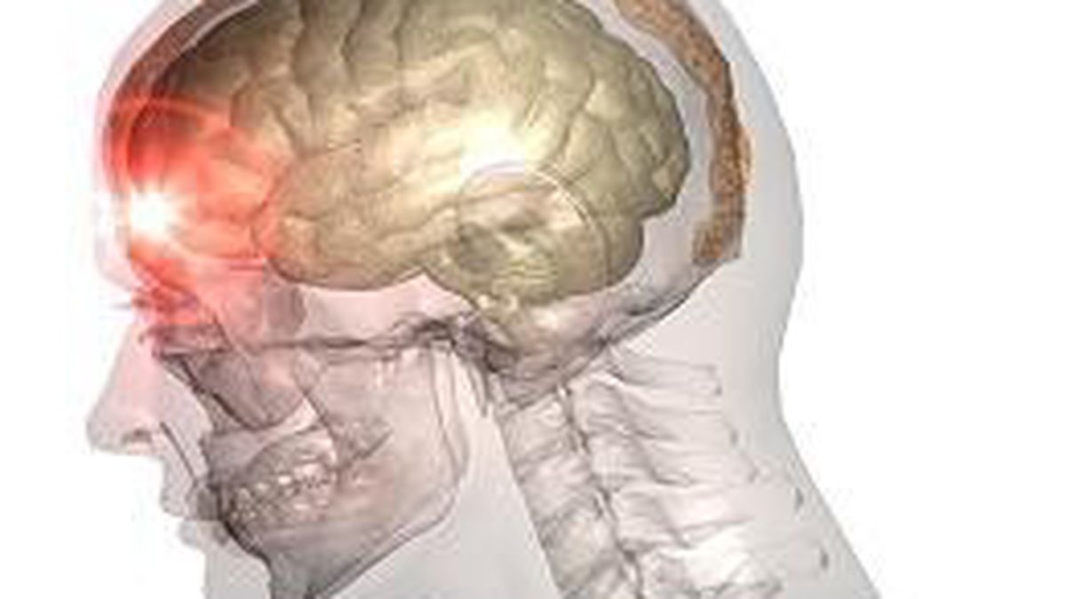 Сотрясение мозга армия. Повреждения черепа и головного мозга. Боевые травмы черепа и головного мозга. Открытые повреждения черепа и головного мозга.