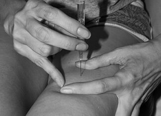 Harm Reduction: Supervised drug injection sites could soon pop up in California—how will they work?