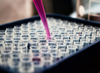 Exploring Peptide Bonds: The Molecular Links of Science Peptide bonds